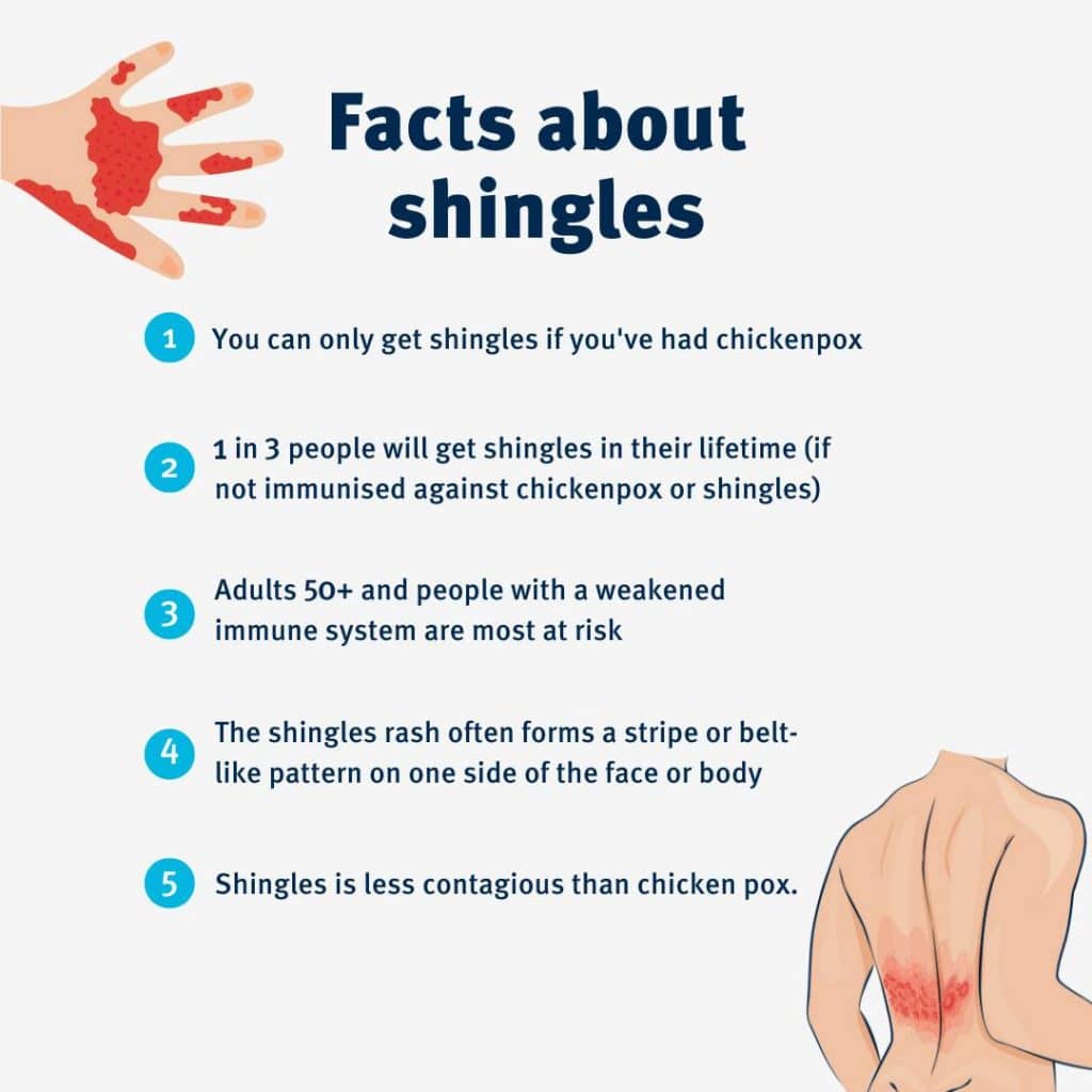 Shingles Catch up Vaccines Are Available For Adults Aged 71 To 79 Years 